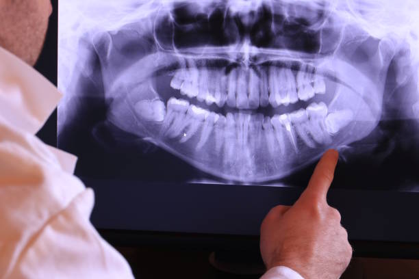 Best Emergency Tooth Extraction in Smithville, OH