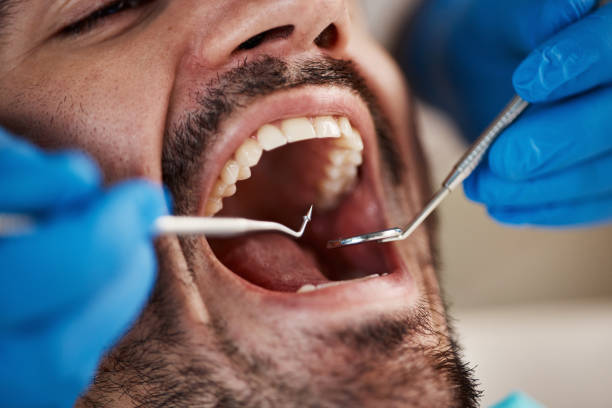 Best Emergency Tooth Extraction in Smithville, OH